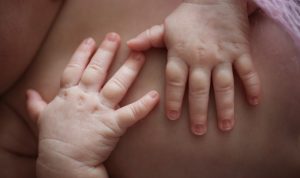 bayi dengan kulit sensitif